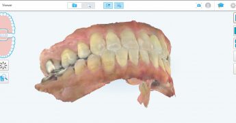 My iTero Viewer　山梨　あいざわ歯科クリニック